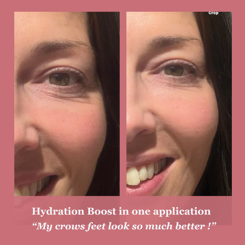 Before and after comparison of a woman's face with text about hydration boost and crows feet reduction.