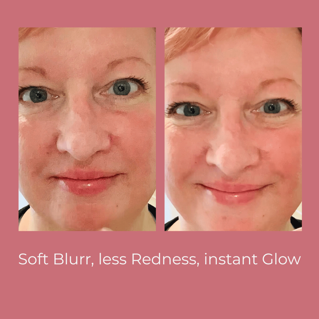 Lifestyle image of Soft Baby Moisturising Balm