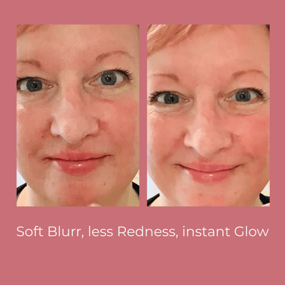 Lifestyle image of Soft Baby Moisturising Balm