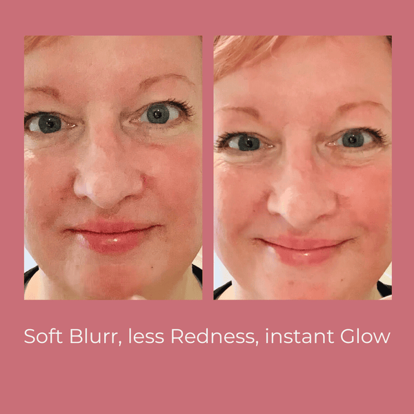 Lifestyle image of Soft Baby Moisturising Balm