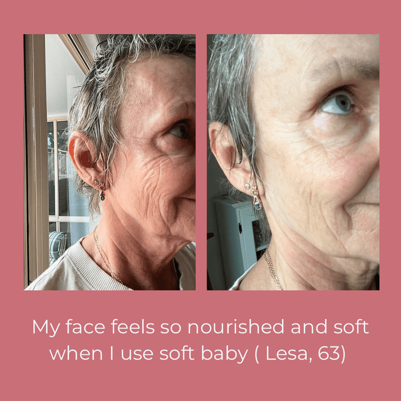 Lifestyle image of Soft Baby Moisturising Balm
