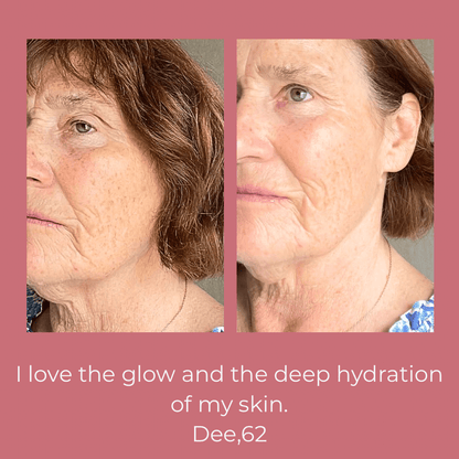 Lifestyle image of Soft Baby Moisturising Balm