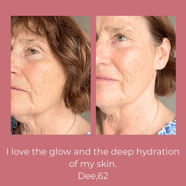 Lifestyle image of Soft Baby Moisturising Balm