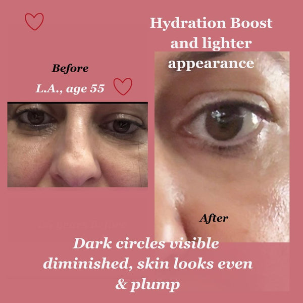 Before and after results using Soft Baby