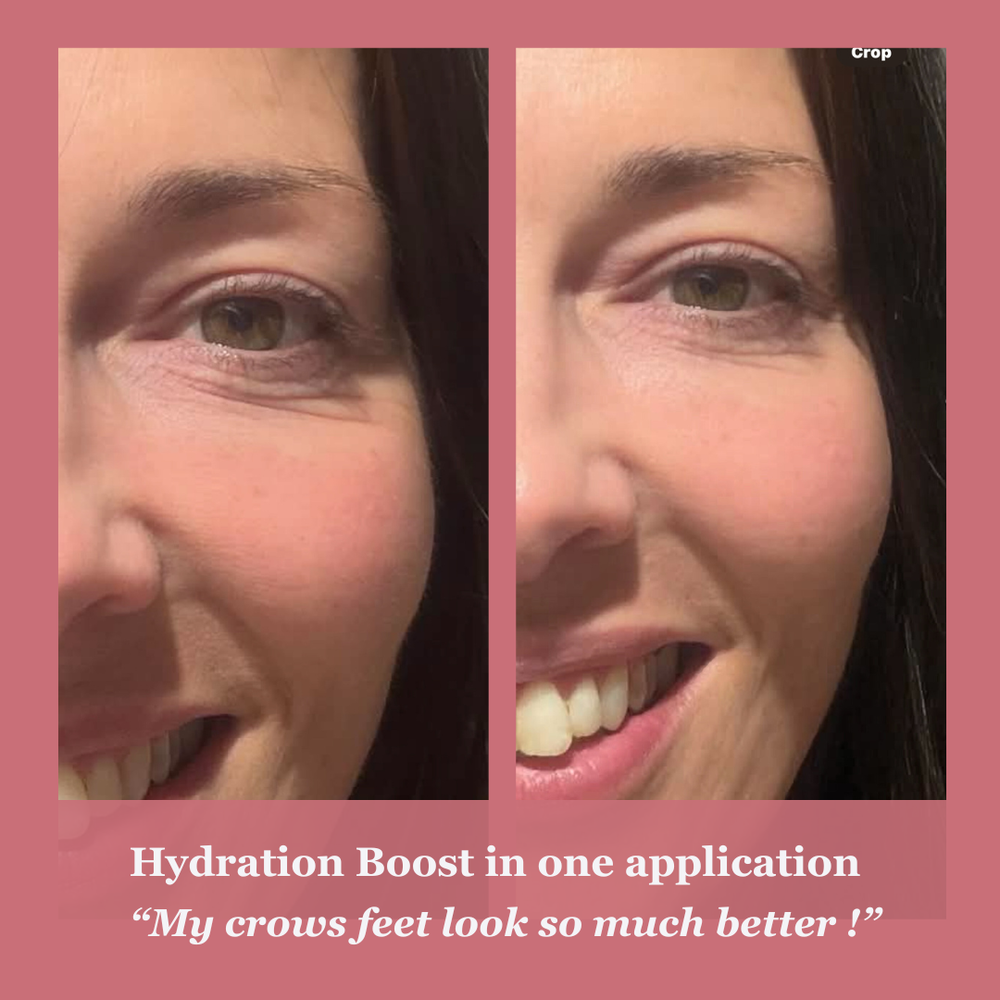 Original Soft Skin customer skin-story image